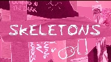 Okładka teledysku Skeletons